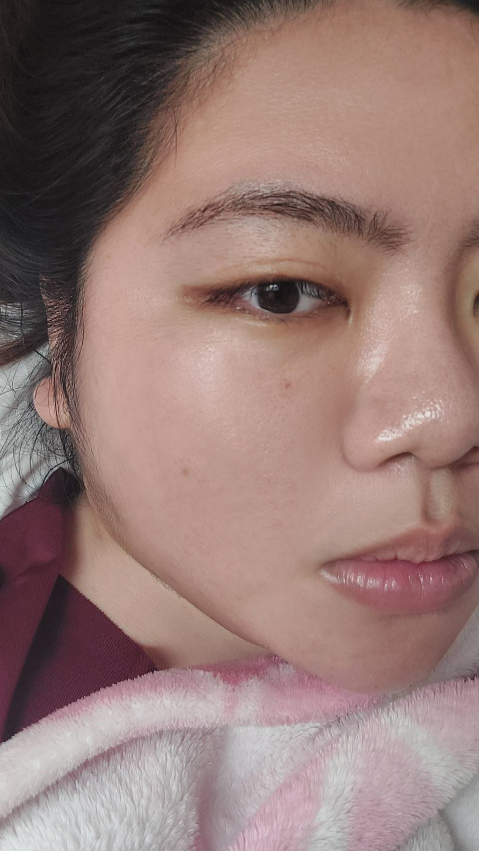 術後第一天肌膚光澤感紀錄
